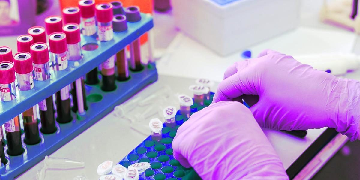 Noticia: Jornada de Presentación del Programa de Doctorado en Ciencias Biomédicas y Salud Pública ISCIII/UNED