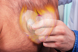 Enfermedades cardiovasculares