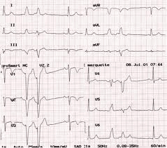 Cardiograma